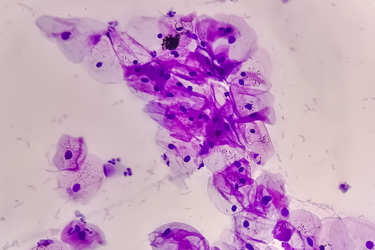 Photomicrograph of human cervix cells.