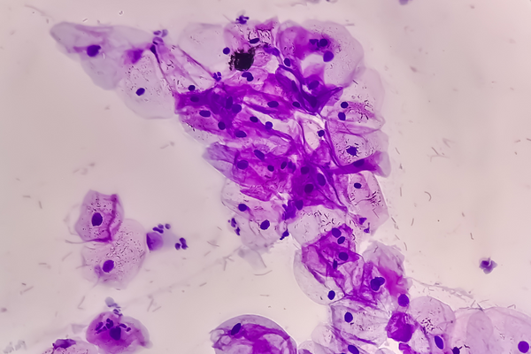 Can HPV Cause Pain During Sex?